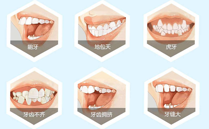什么样的牙齿需要美容？